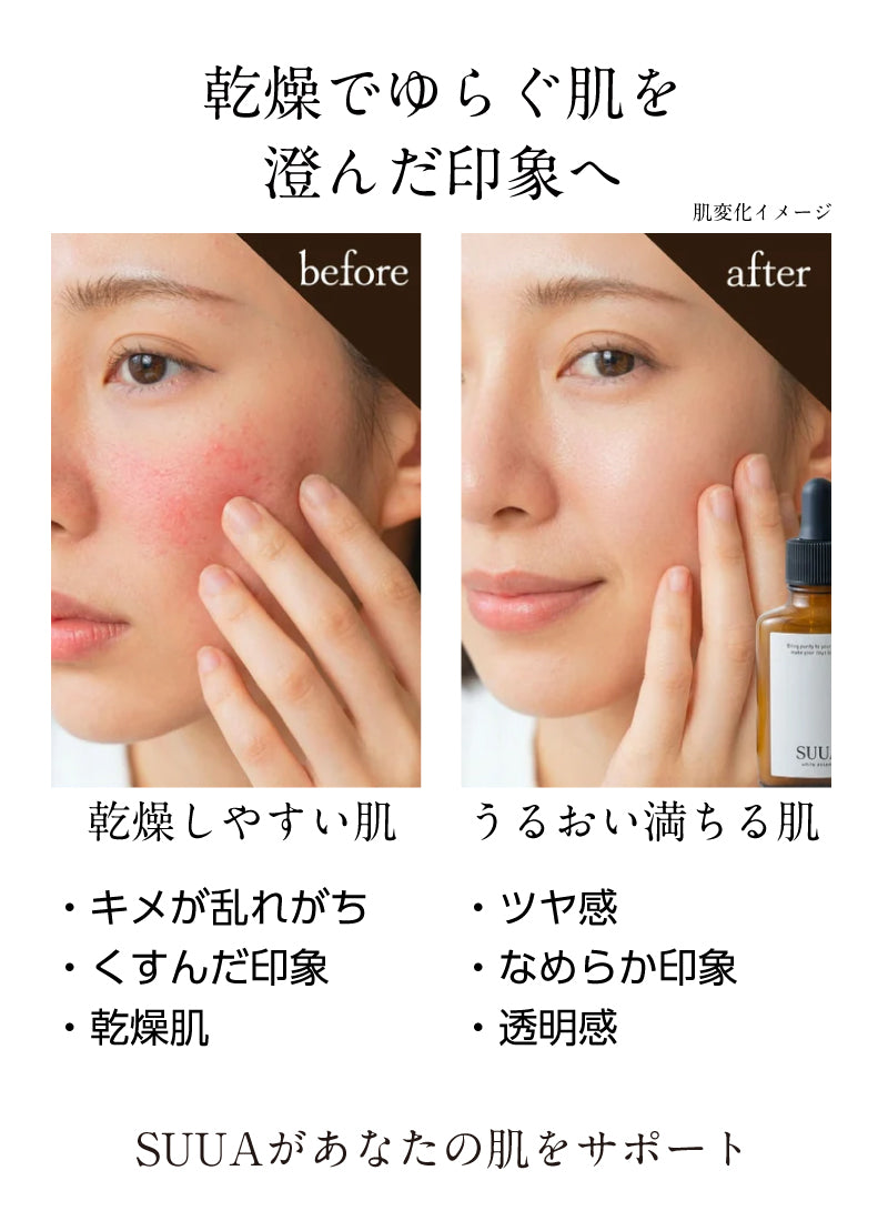 SUUA. （スーア）　美白美容液 30ml
